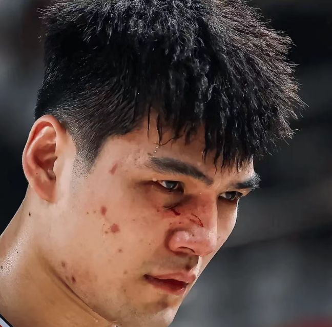 伤痕明显！广州状元陈国豪面部骨裂 季后赛大概率戴面具对阵广东 缩略图